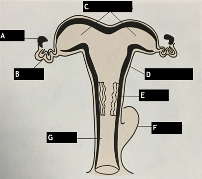 <p>label the different parts of a female reproductive tract (uterus)</p>