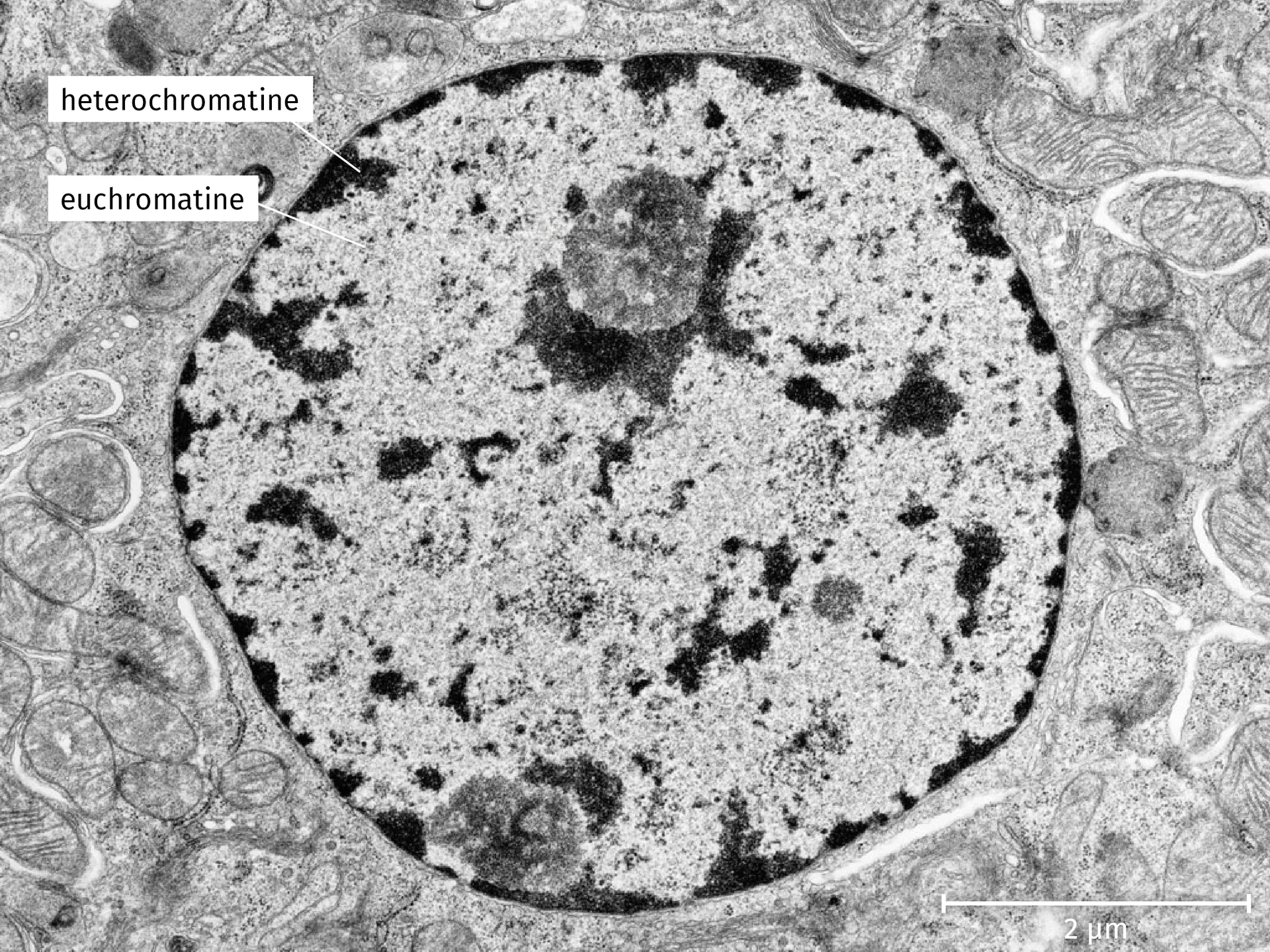 <p>Op een elektronenmicroscopische afbeelding van een celkern zie je duidelijk het onderscheid tussen beide.</p>