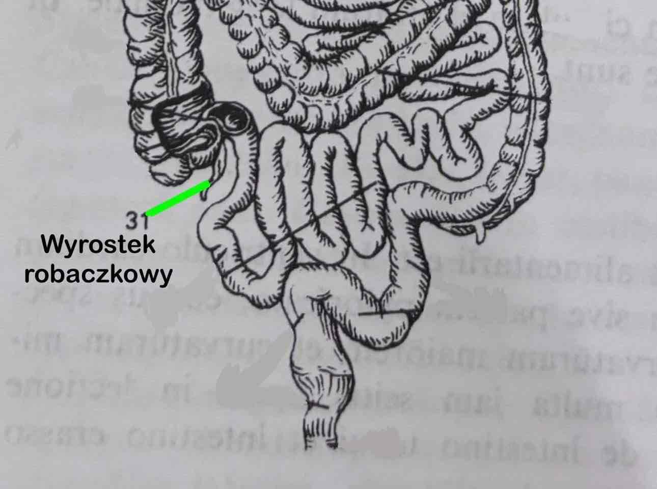 <p>Wyrostek robaczkowy</p>