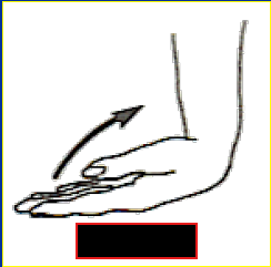 <p>What Movement is occurring?</p>