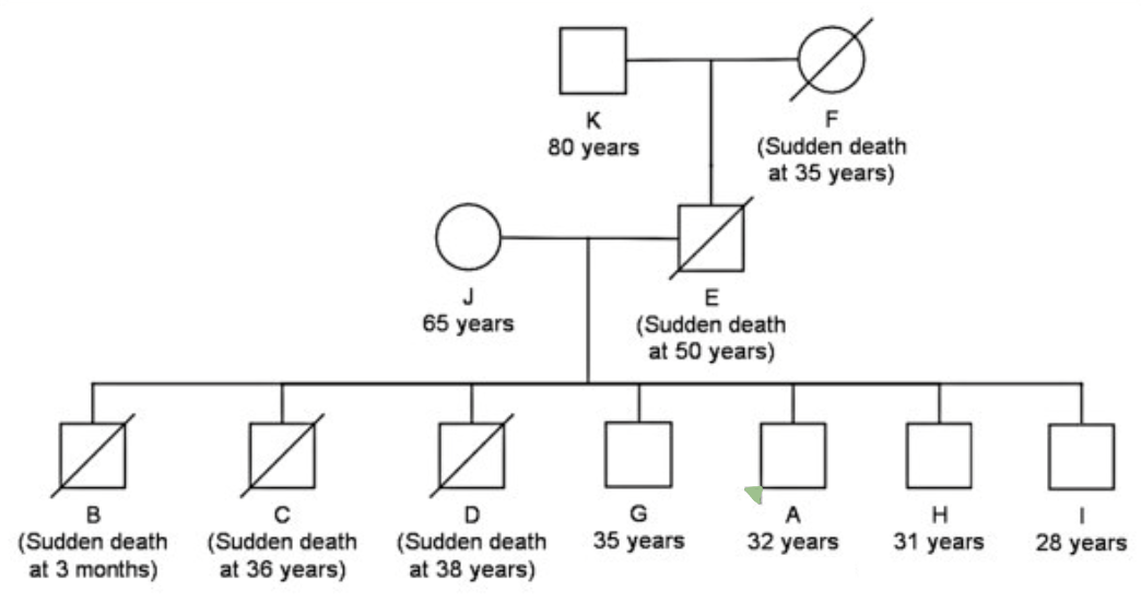 This family is from the Philippines and have had minimal access to high level healthcare. Most sudden deaths occurred during sleep. The proband has a history of syncope and his brother (D) and father (E) did as well. The family calls the condition “bangungot.” What condition is this? What does this tell us about cardiac conditions and cultural barriers? 