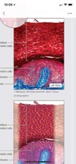 - Multiple layers of cells
-Flat, apical cells are alive and moist
- Function- protection
FOUND- lining of vagina, lining of oral cavity.
