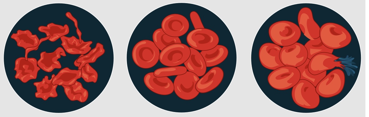 <ul><li><p>Isotonic Solution</p></li><li><p>Hypertonic Solution</p></li><li><p>Hypotonic Solution</p></li></ul><p><br></p>