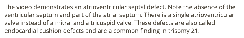 <p>c) atrioventricular septal defect</p>