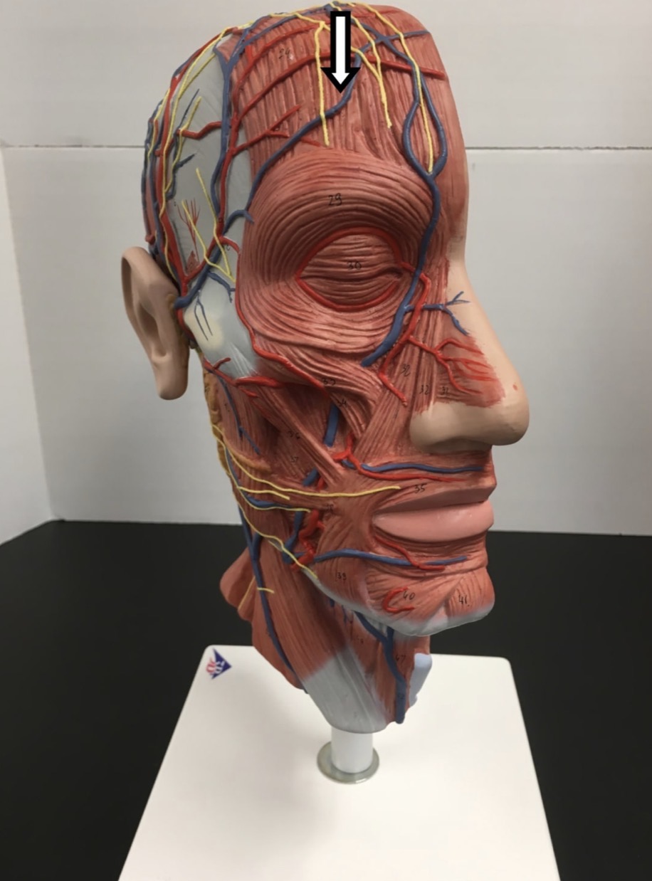 <p><span>Name the muscle labeled with the white arrow below:</span></p>