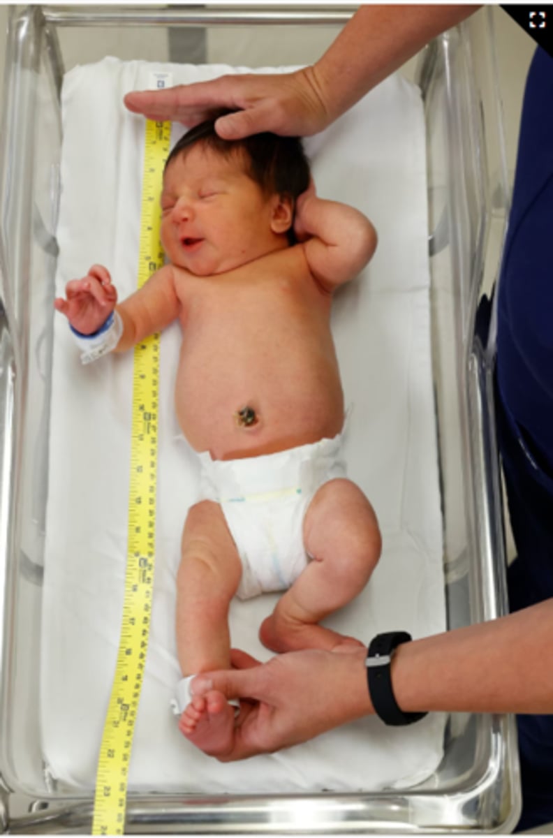 <p>This is measured in children 2 years of age and under. It is done using a measuring board OR a non-stretchable measuring tape. Length is measured from the top of the head to the bottom of the heel in the SUPINE position. EXPECTED is between 45 to 54 CM with an AVERAGE of 50 CM.</p>