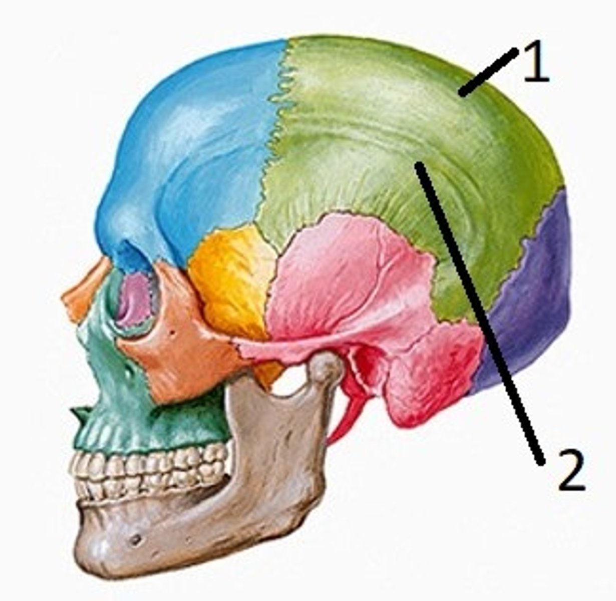 <p>A) parietal tubercles</p><p>pg. 379: the widest portion of the entire skull is located between parietal tubercles (eminences) of the two parietal bones.</p>