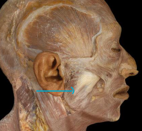 <p>what muscle?</p>