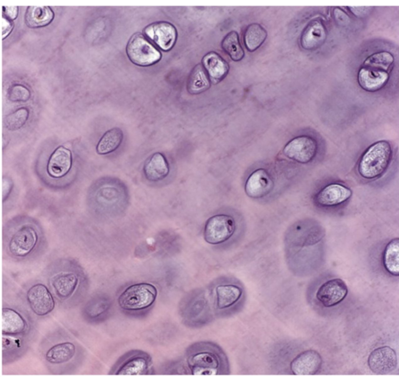 <p>Which type of cartilage is the most common in the body? ***</p>