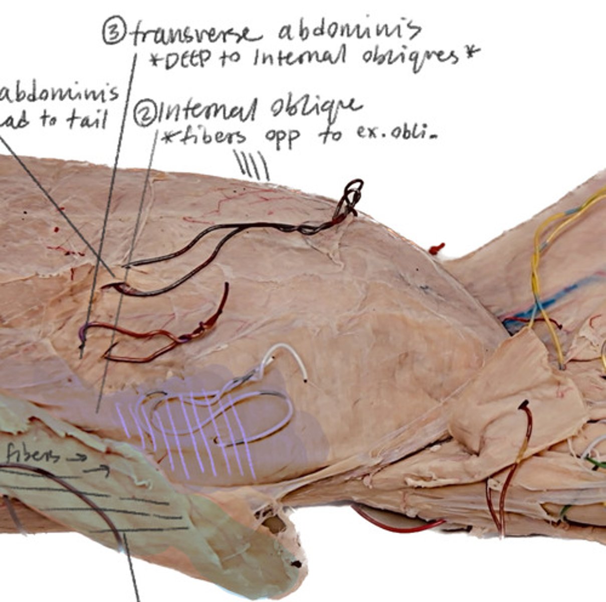 <p>Deep to internal obliques</p>