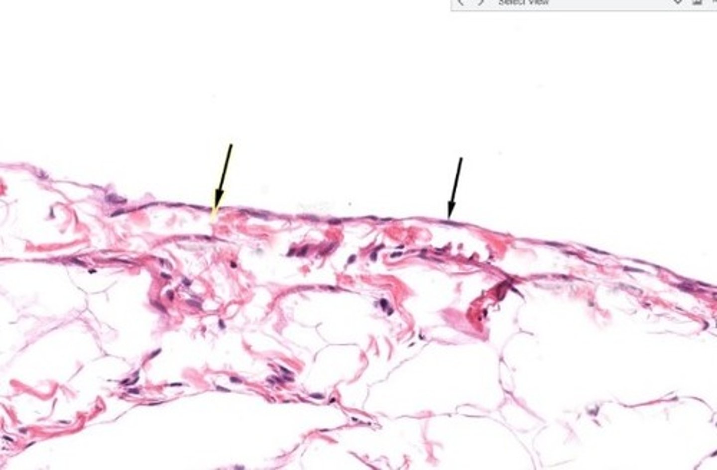 <p>mesentery of ovary and oviduct</p>
