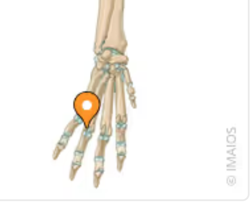 <p>Located behind the joint and between the large metacarpal bone and the proximal phalanx joint in the large, digital, flexor tendons - or Fetlock Joint. Sometimes fracture in horses. </p>