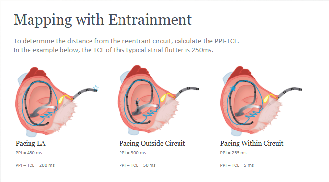 <ol><li><p>Measure the TCL</p></li><li><p>Pace the atrium at 10-20 ms faster than TCL - overdrive suppression</p></li><li><p>Atrial rate should increase to pacing rate - confirm capture</p></li><li><p>Measure the post-pacing interval - time from end of pacing stimulus to propagate around circuit and back to pacing site</p></li><li><p>Take PPI - TCL, if &lt; 30 ms, we are pacing from within the circuit. </p></li><li><p>CHECK IF MANIFEST OR CONCEALED based on atrial activation sequence </p></li></ol><p></p>