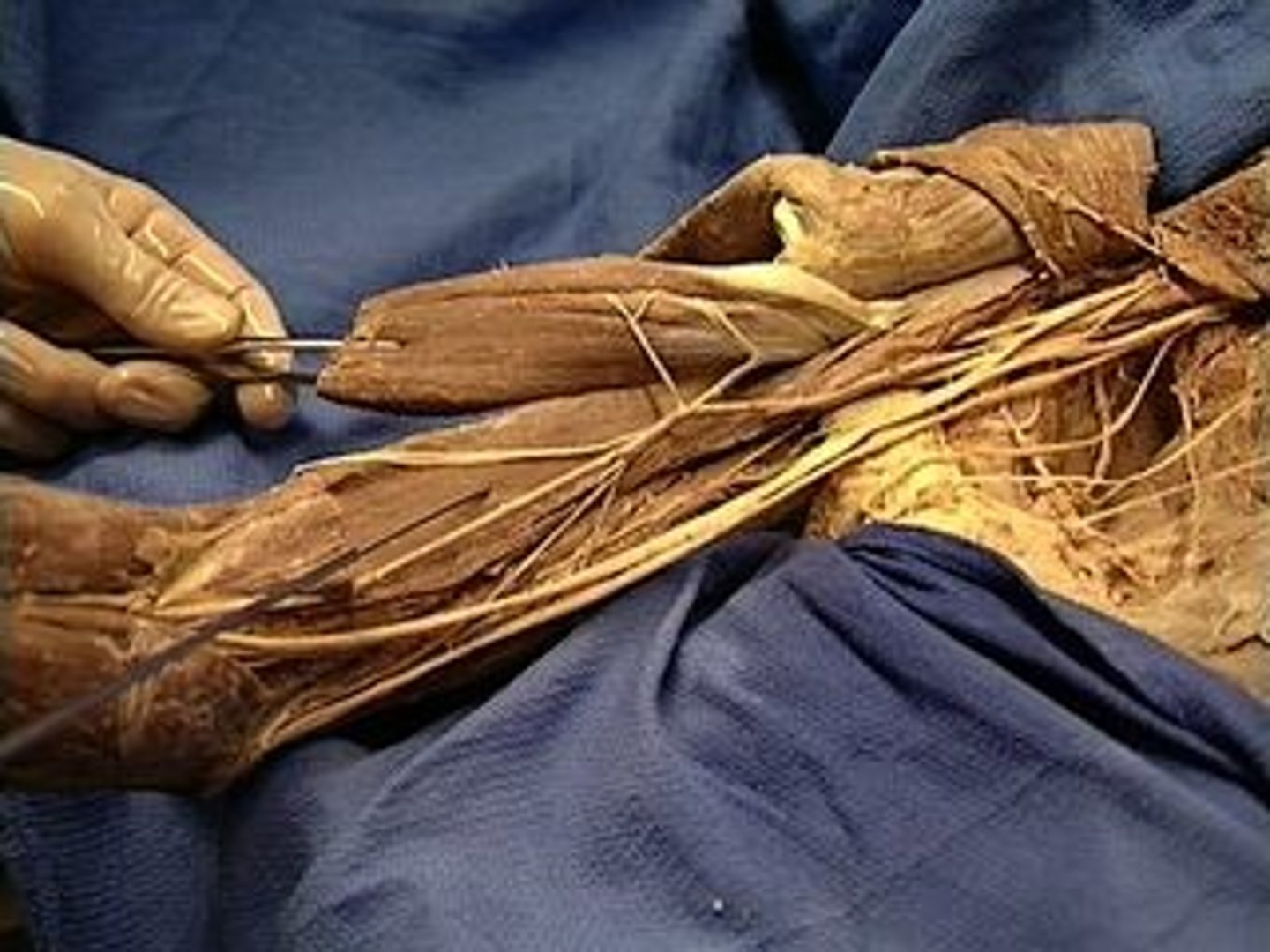 <p>Aids in elbow flexion with the Biceps Brachii.</p>