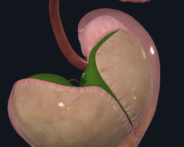 <p>What area of the liver is highlighted green</p>