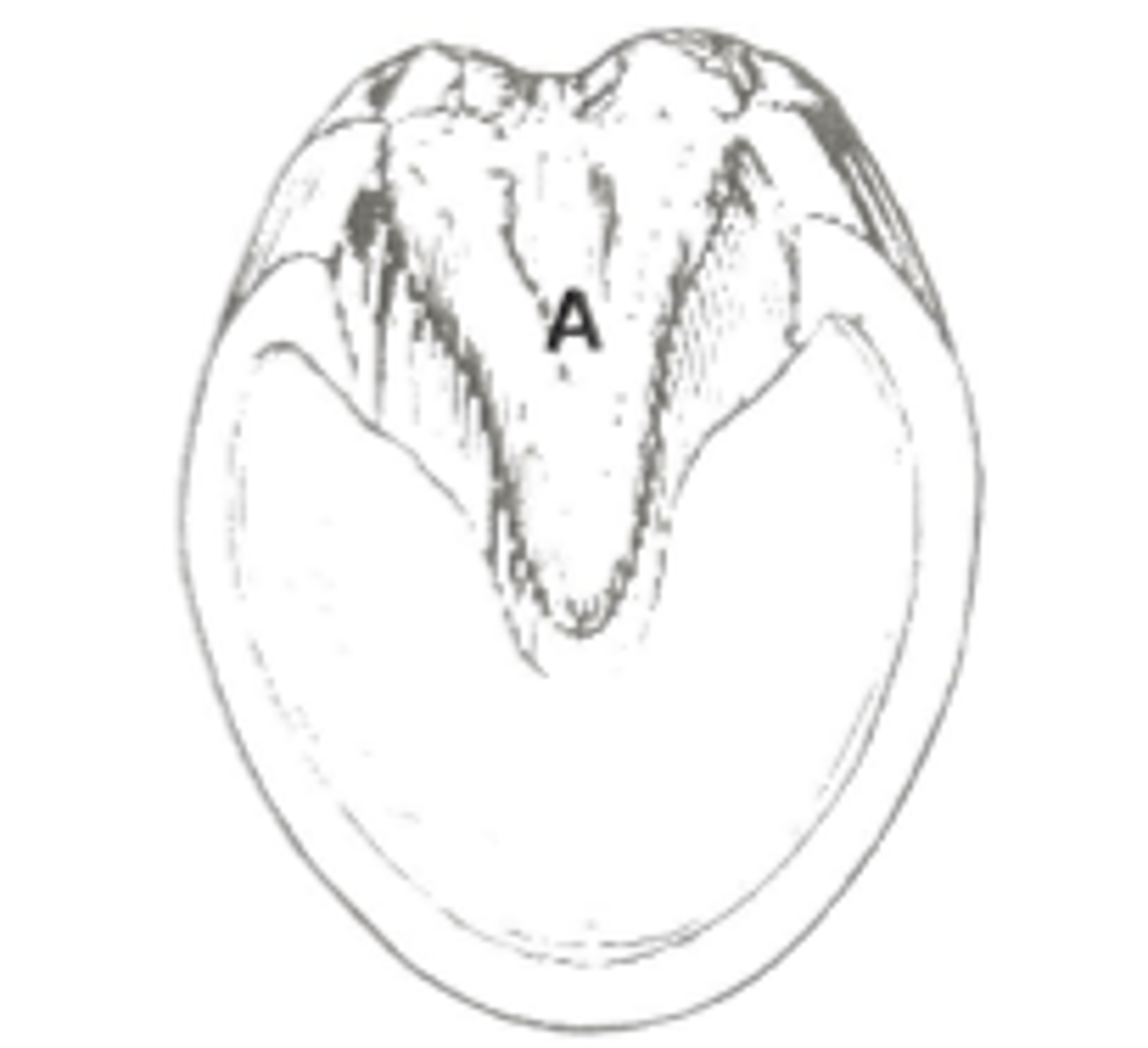<p>What synovial structures would be encountered by a puncture at A?</p>