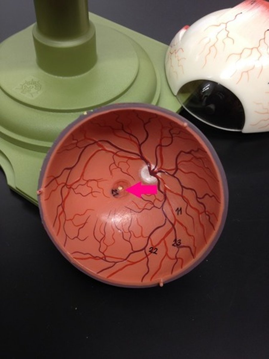 <p>Identify the brown region.</p>