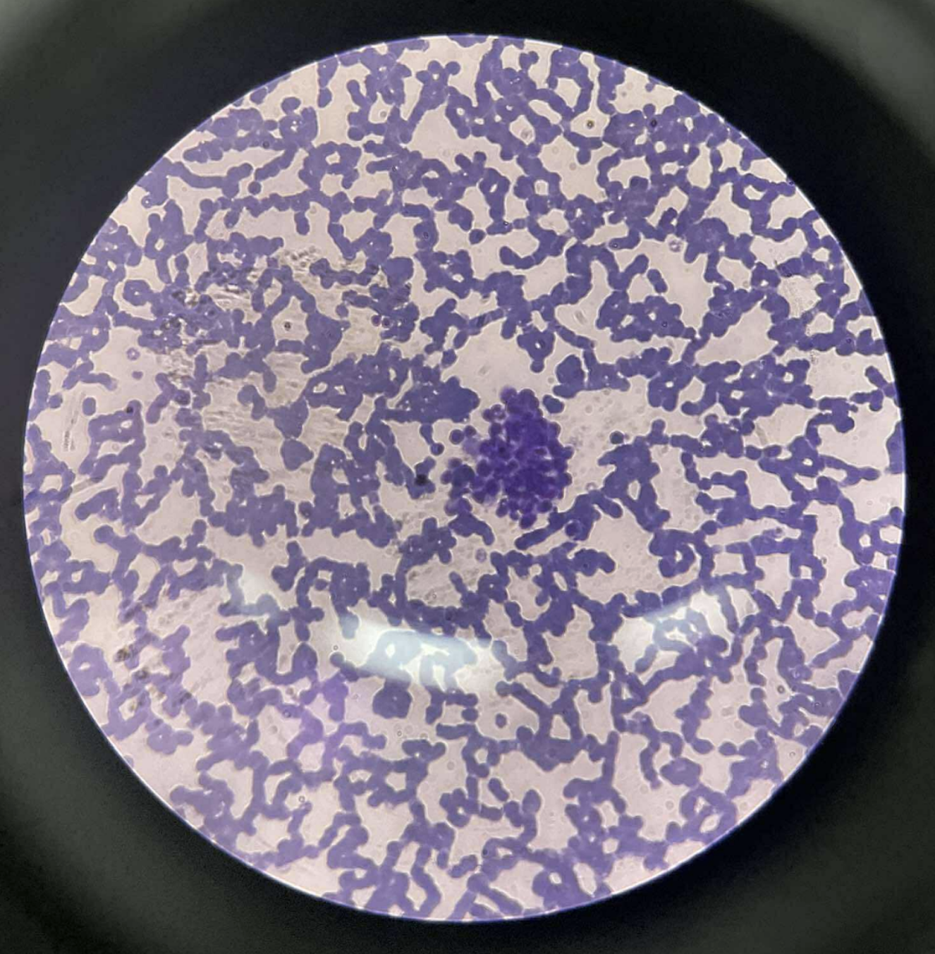 <p>specimen</p><p>phylum</p><p>color</p><p>shape</p><p>cell arrangement</p><p>motility</p><p></p><p>found</p><p></p><p>disease</p><p>prevention</p><p>treatment</p><p></p><p>life cycle</p><p></p>