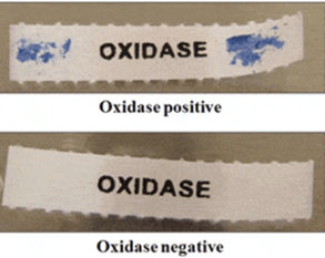 <p><mark data-color="yellow">Chemical reactions - oxidase</mark></p><p>Can you label, describe and explain what this diagram is/shows?</p>