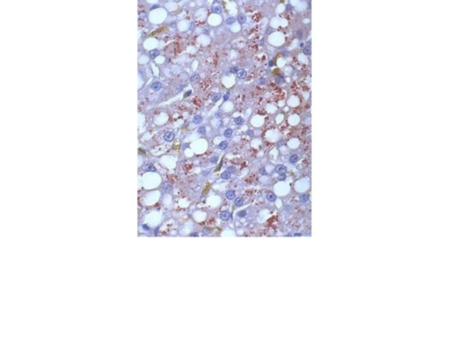 <p>"Dane particle" = infectious form</p>