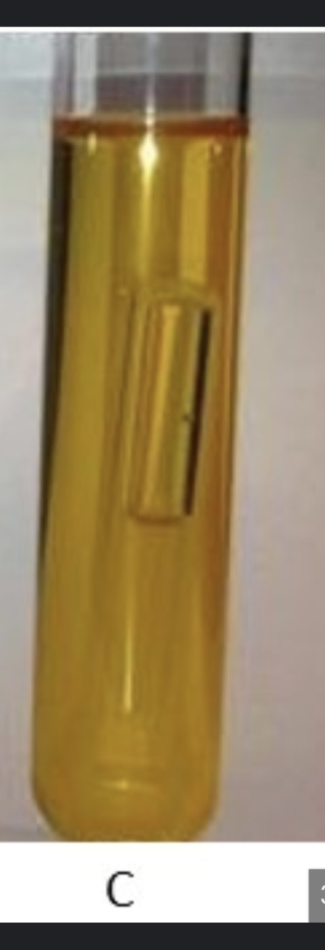 <p>What does it mean if phenol Red is yellow with a positive Durham tube.</p>