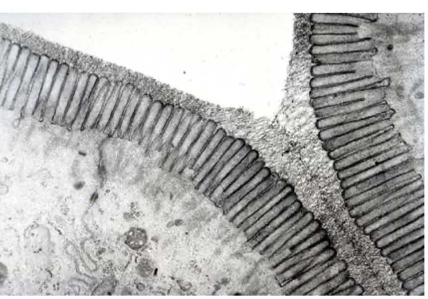<p><strong>A carbohydrate-rich coating on epithelial cells.</strong></p><p>Functions:</p><ol><li><p><strong>Recognises luminal antigens</strong></p></li><li><p><strong>Protective coating for bacteria</strong></p></li><li><p><strong>Supports epithelial adhesion</strong></p></li></ol><p></p>