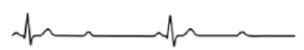 <p>ECG - What is this?</p><p>Describe it</p><p>Ausc Aspect?</p>