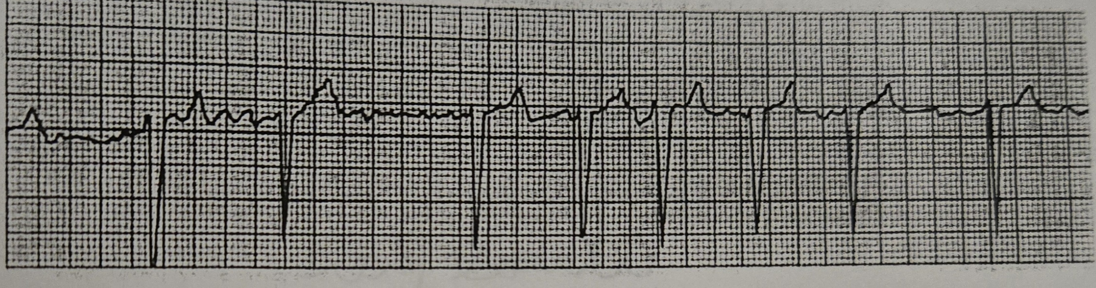 <p>What Rhythm is this?</p>