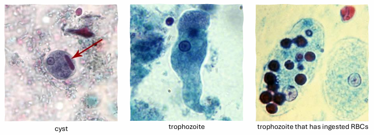 <p>-stool microscopy</p>