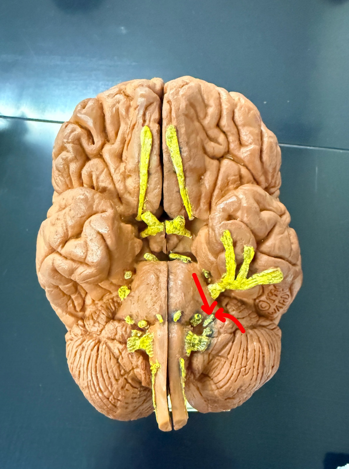 <p>Name the cranial nerve on the brain model</p>