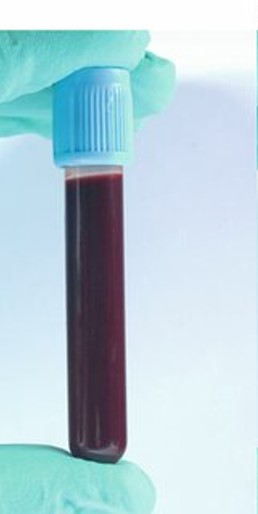 • A viscous mixture of fluid containing formed elements suspended in plasma.

• Transports dissolved substances, establishes hemostasis, involved in defense against pathogens, regulates pH by buffer action, and regulates body temperature.