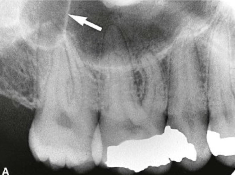 term image