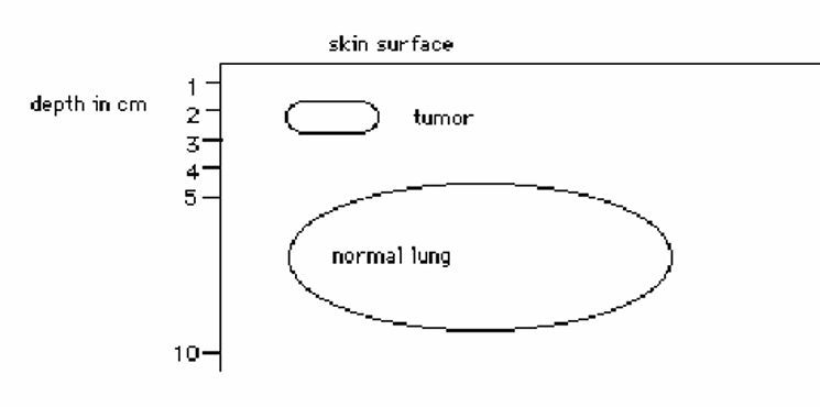 <p>What electron beam energy would be appropriate for treating the following, providing adequate dose throughout the entire tumor volume:</p>