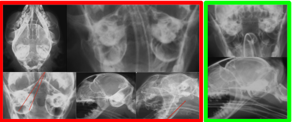 <ul><li><p><strong>Cause:</strong></p><ul><li><p><strong>Bacteria mid ear infection</strong></p><ul><li><p>secondary to <u>chronic otitis external</u></p></li></ul></li><li><p><strong>Floppy </strong>eared <strong>old</strong> dogs</p></li></ul></li><li><p><strong>CS:</strong></p><ul><li><p>Head tilt, ear pawing, exudate, seizures</p></li></ul></li><li><p><strong>Views:</strong></p><ul><li><p>Closed mouth VD, open mouth VD, obliques</p><ul><li><p><u>CT / MRI is preferred</u></p></li></ul></li></ul></li><li><p><strong>RS:</strong></p><ul><li><p><strong>Thick osseous bulla</strong> with<strong> lysis,</strong> <strong>increased soft tissue density in bulla, mineralization of external ear canals</strong>, increased opacity of tympanic bullae, nasopharyngeal <strong>polyp</strong></p></li></ul></li></ul><p></p>