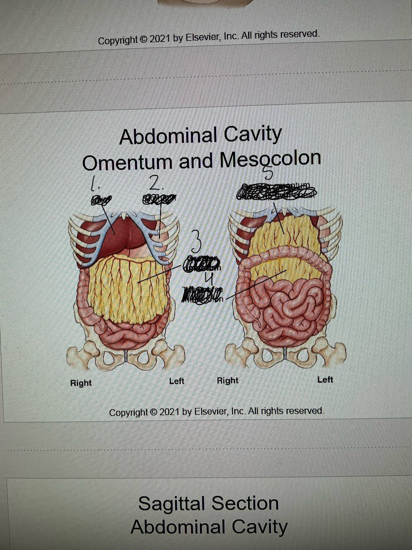 <p>What is 4 pointing at</p>