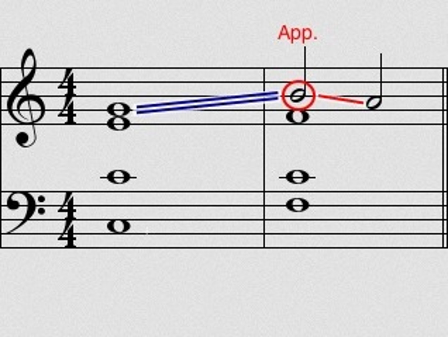 <p>An ornamental note that falls on the beat as a dissonance and then resolves by step onto the main note - puts emphasis on the grace note.</p>