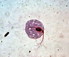 <ul><li><p>Parasite is pear-shaped organism; central nucleus, four anterior flagella, and an undulating membrane</p></li><li><p>It exisrs only in the trophozoite form (infective and pathogenic)</p></li><li><p>It is not an intestinal pathogen. It causes urogenital infections and transmitted through sexual intercourse</p><ul><li><p>Isolated form the urethra and vagina&gt;in infected women; Isolated in the urethra and prostate gland&gt;in infected men</p></li></ul></li><li><p>Infection is highest among sexually-active women in their thirties and lowest in postmenopausal women.</p></li><li><p>Occasionally, the parasite may be transmitted through toilet articles and clothing of infected individuals</p></li><li><p>Infants may be infected as they pass through the infected birth canal during delivery</p></li><li><p>the parasite invades the vaginal mucosa of infected women, where they multiply through binary fission</p></li><li><p>the trophozoites feed on local bacteria and leukocytes</p></li><li><p>In men, most common infection site is the prostate gland and the urethral epithelium</p></li></ul><p></p>