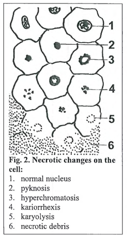 <p><strong>Necrosis hepatis centrolobularis</strong></p>