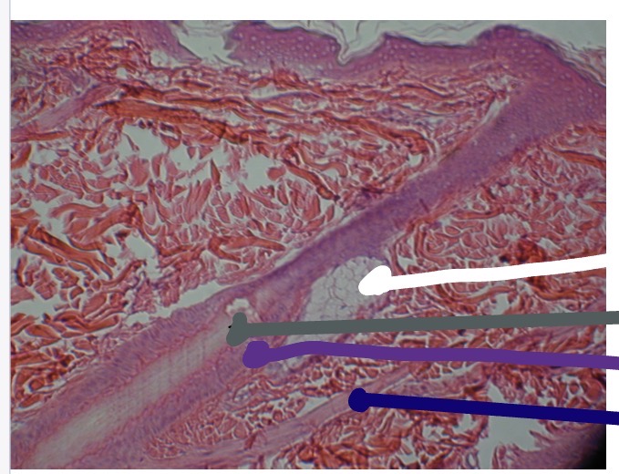 <p>What is the purple line in the photo</p>