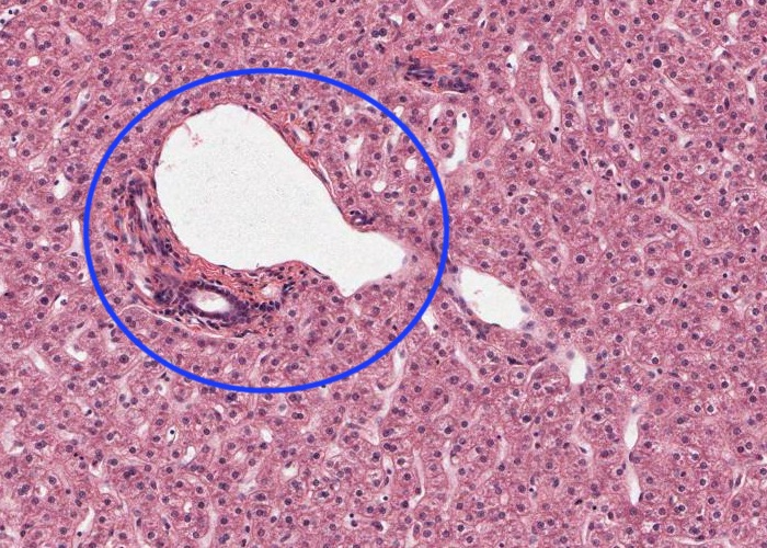 <p>The structure circled is a?</p>