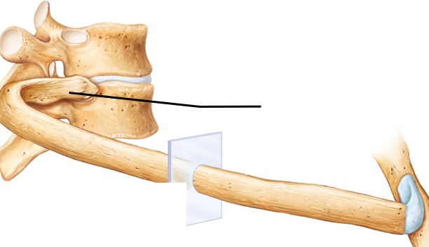 <p>What bone structure is the arrow pointing to?</p>