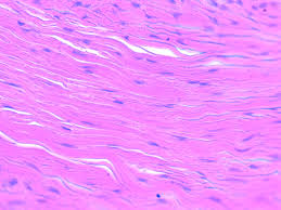 <p>Connective tissue with parallel collagen fibers; forms tendons and ligaments.</p>