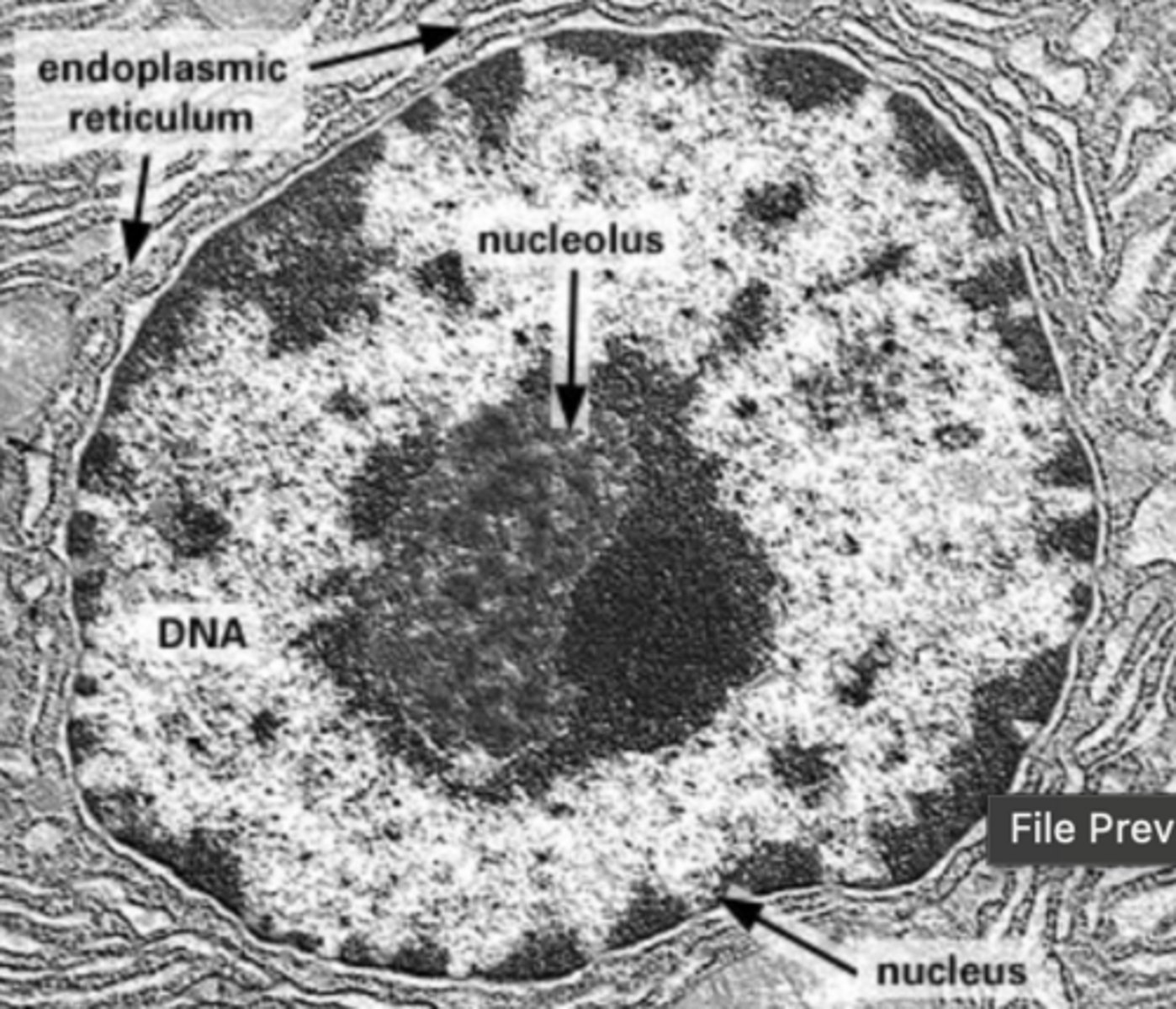<p>-Dense region within the nucleus</p><p>-Clustered region of ribosomal RNA genes</p><p>-Surrounded by specific RNAs and proteins</p><p>-Site of ribosomal subunit synthesis</p>