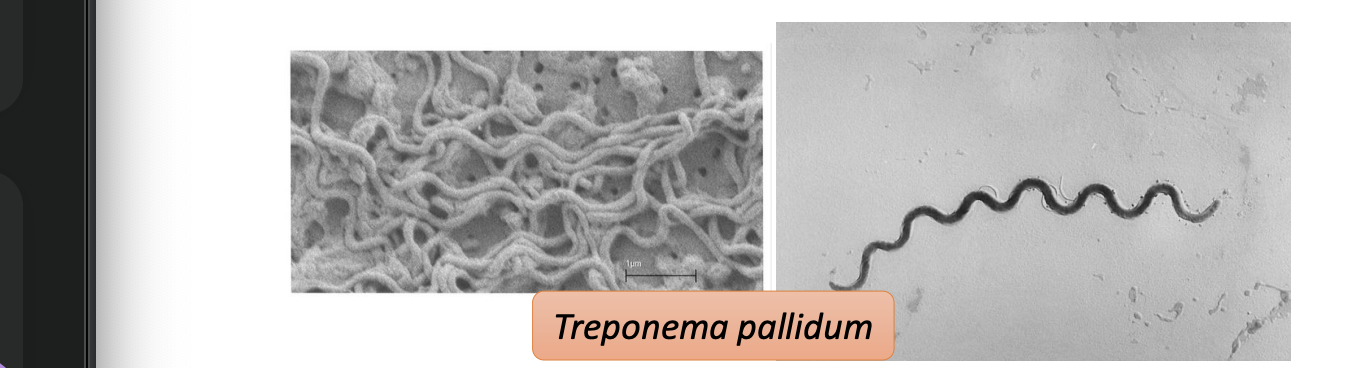 <p>Domain Bacteria : Spirochetes</p>