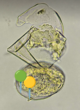 <p><span data-name="worm" data-type="emoji">🪱</span><span data-name="flag_jp" data-type="emoji">🇯🇵</span><span><span> </span></span><strong><em>Schistosoma japonicum </em></strong><sub>(Jaja)</sub></p><p></p><p></p><p><span>🧩🦠 </span><strong>Organelle:</strong></p><p></p><ul><li><p><span>🟡 - kolec (nie do końca poprawnie ułożony - poprawnie byłby zwrócony w drugą stronę, ale trudno);</span></p></li></ul><p></p><ul><li><p><span>🟢 - skorupka.</span></p></li></ul><p></p><p></p><p><span>😷❓ </span><strong>Parazytoza:</strong><em> Schistosomoza przewodu pokarmowego</em></p>