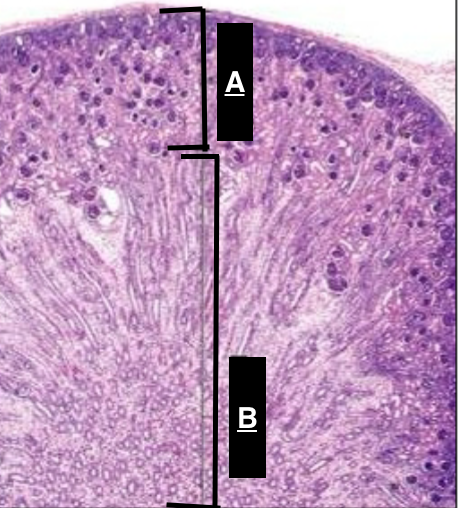 <p>Identify B </p>