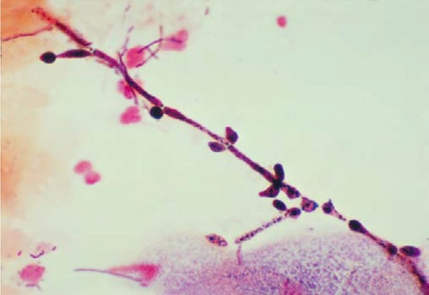<p>b. Candida albicans</p>