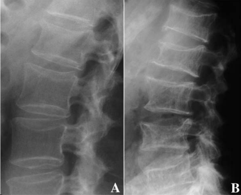 <p>What is abnormal </p>