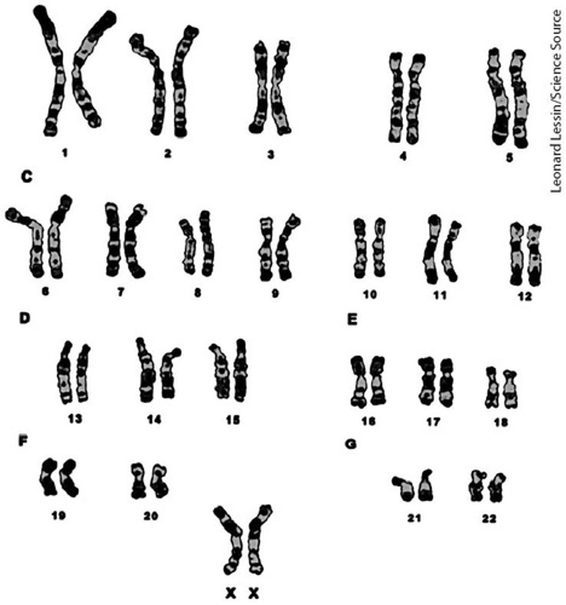 <p>The process of preparing chromosomes from actively dividing cells, halted in metaphase and arranged according to size.</p>
