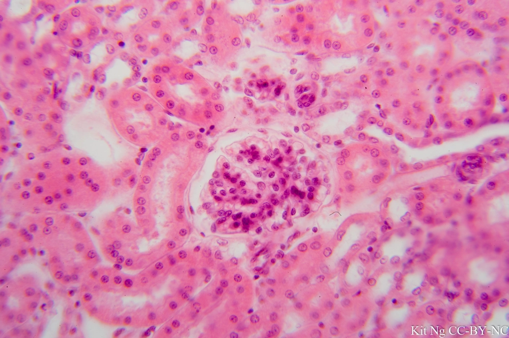 <p>Simple Squamous Epithelium </p>